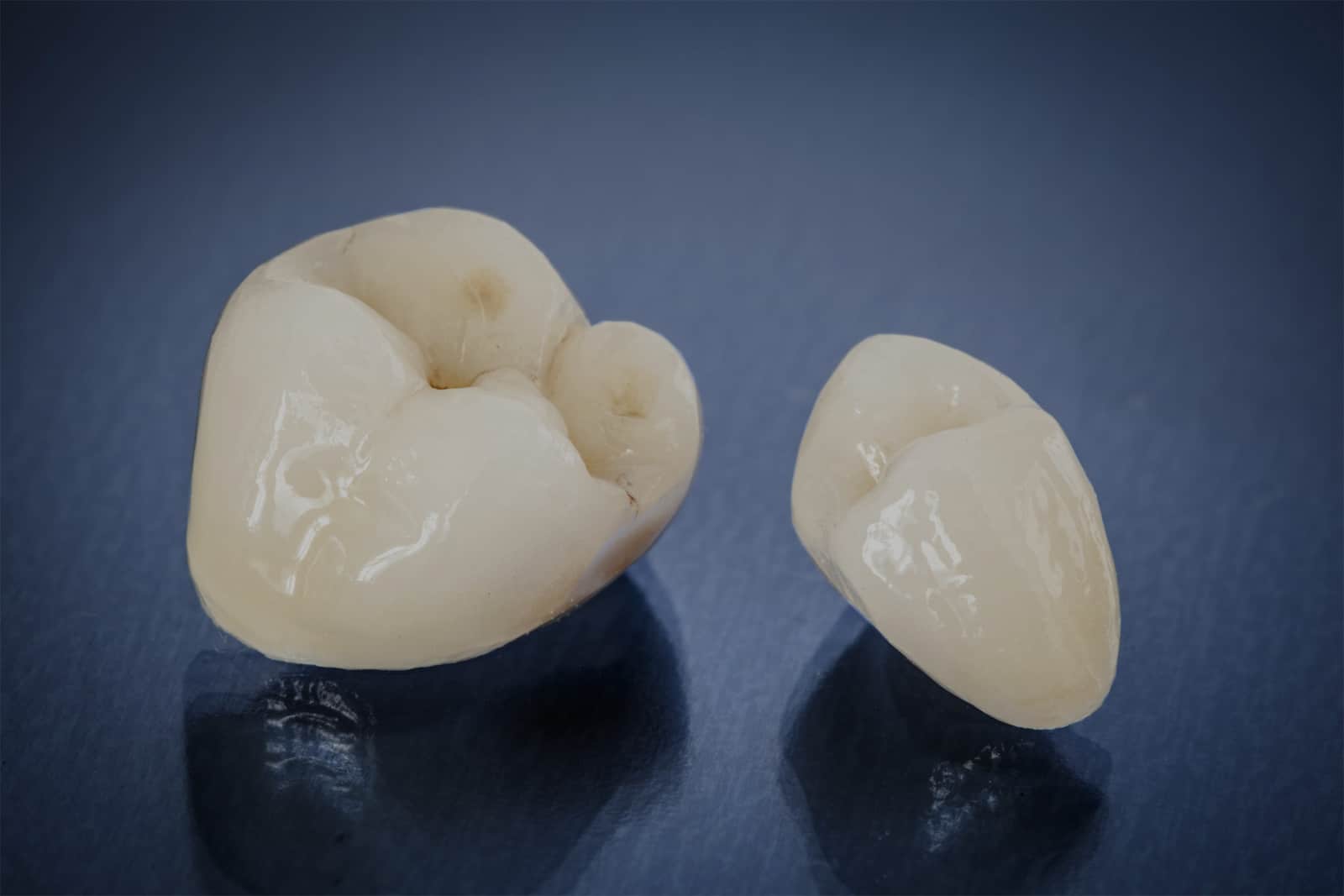 TOOTH CROWNS & DENTAL INLAYS